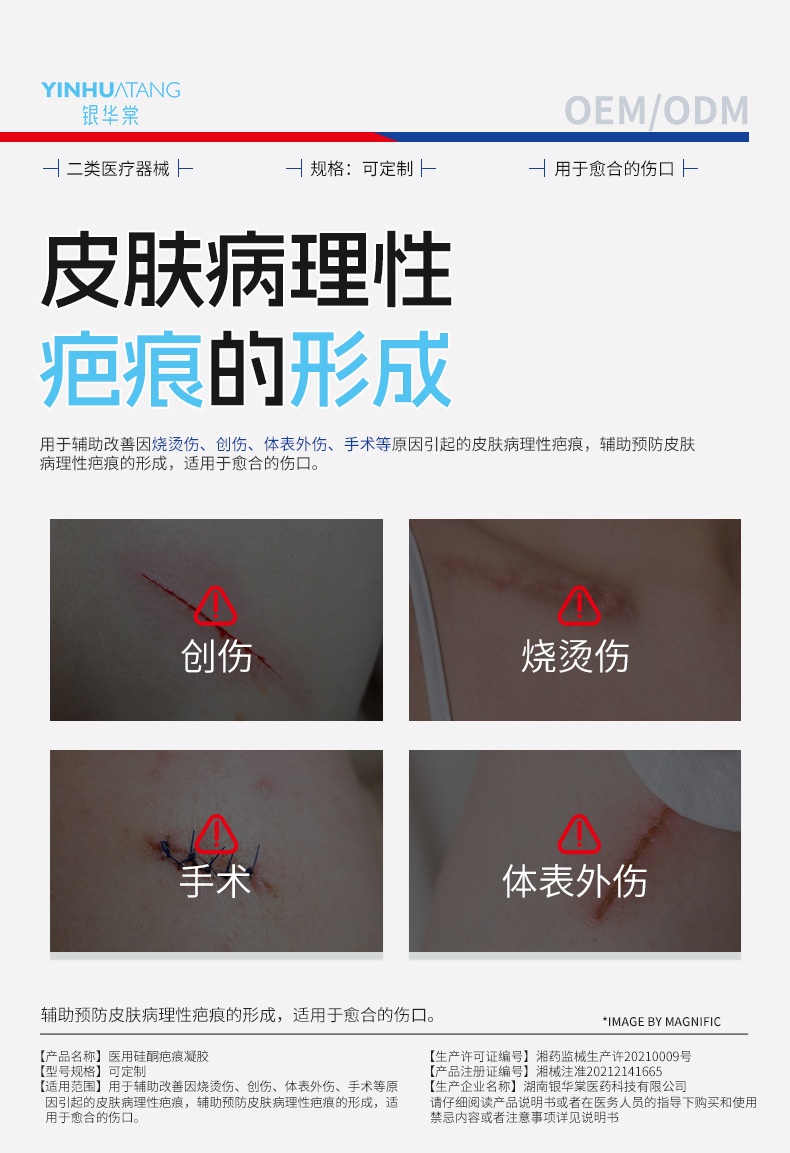医用硅酮疤痕凝胶疤痕修复膏祛疤膏外用改善烧烫伤修护OEM定制
