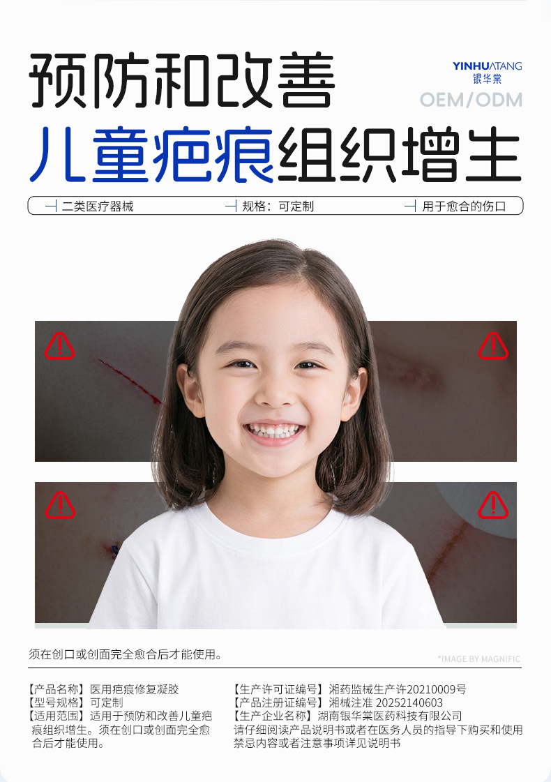儿童疤痕修复膏 医用疤痕修复凝胶改善儿童疤痕组织增生OEM定制