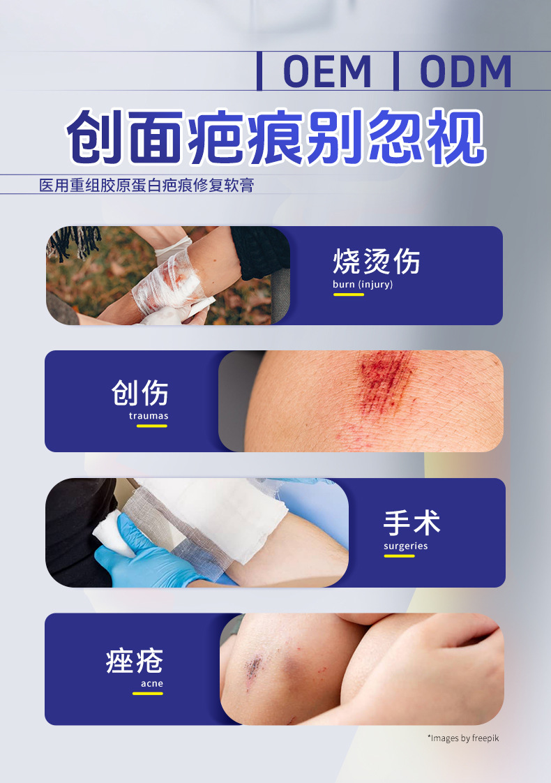 医用重组胶原蛋白疤痕修复凝胶 皮肤修复辅助改善疤痕膏OEM代加工