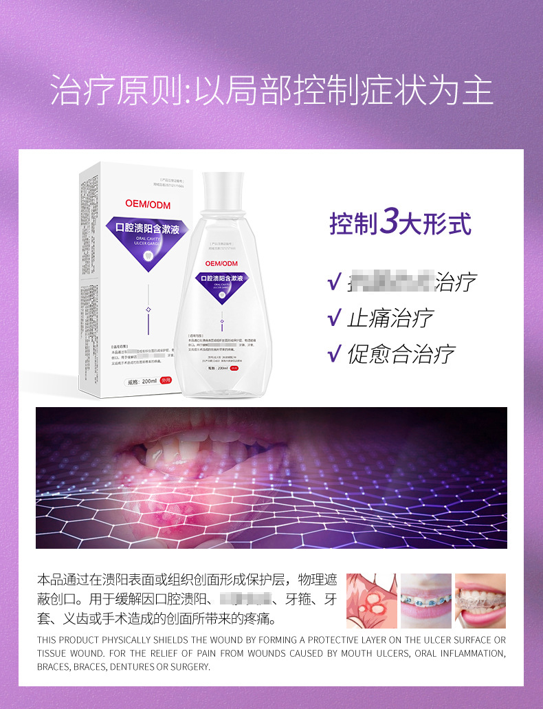 成人儿童口腔含漱液缓解疼痛 男女通用漱口水口腔护理OEM代加工 20+人好评