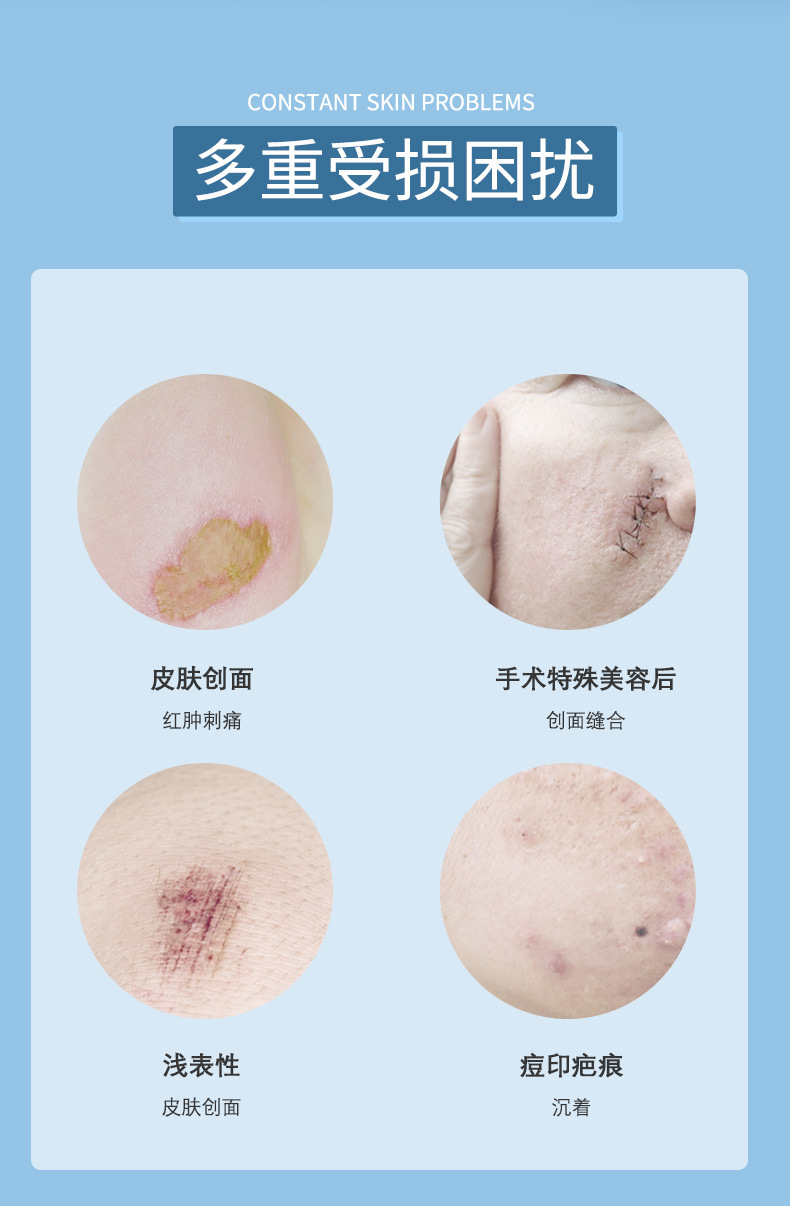 二类医疗器械医用重组Ⅲ型人源化胶原蛋白修护液喷雾瓶款定制OEM