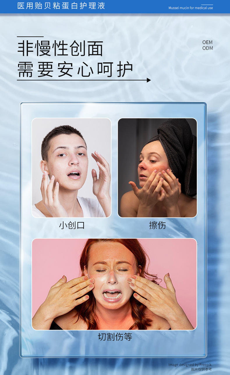 医用贻贝粘蛋白护理液次抛 械字号创面护理精华水精华液oem