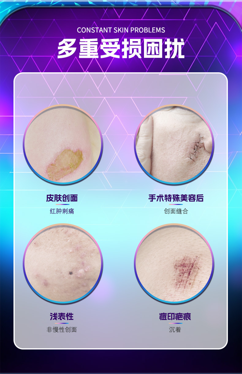 医用重组Ⅲ胶原蛋白修护凝胶保湿补水创面肌肤护理修护外用可定制 70+人好评 200+人已加购