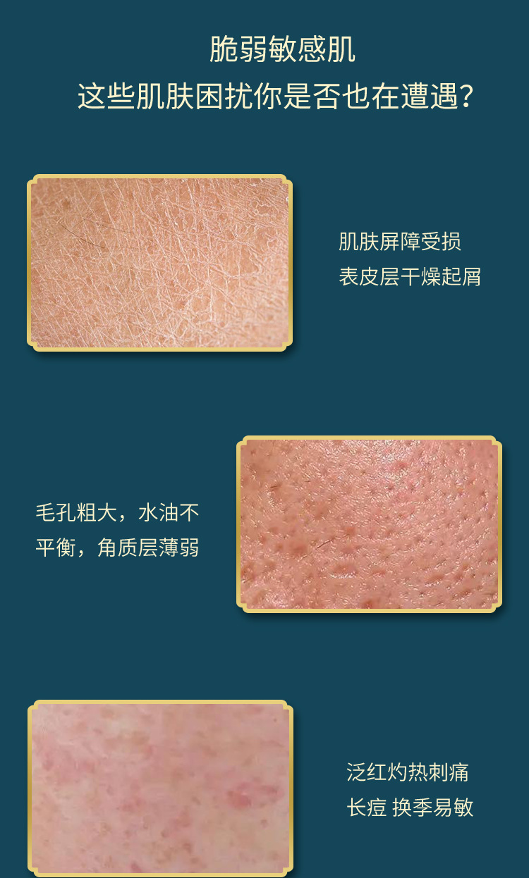 角质层增厚修护精华OEM贴牌加工多重修护调理敏感肌改善加工定制
