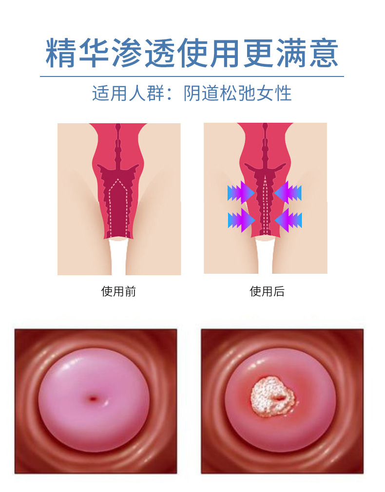 定制妇科臭氧油凝胶 女性清洁抑菌私密凝胶 私处保养套盒消字加工