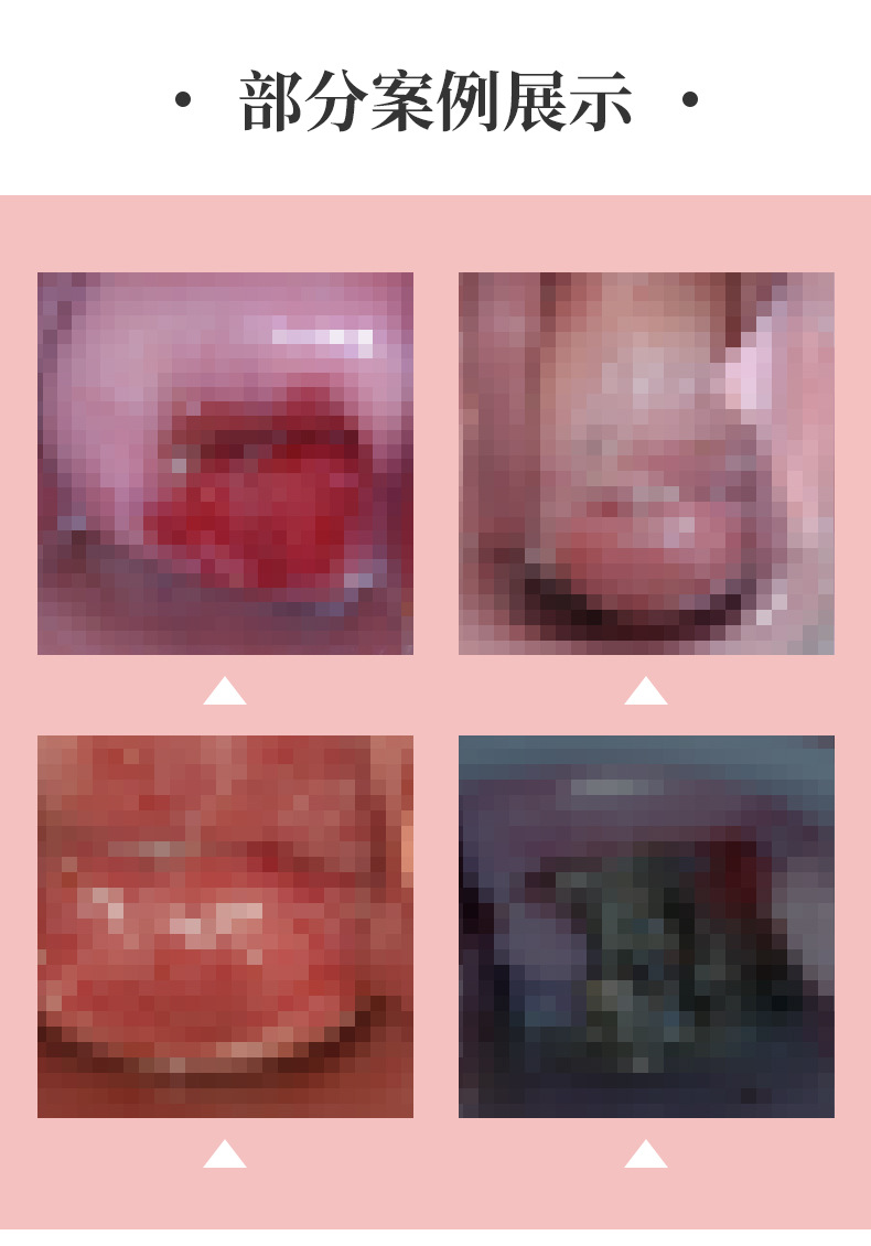 臭氧凝胶oem 妇科臭氧油凝胶 私密抑菌凝胶冷敷私处护理套盒批发