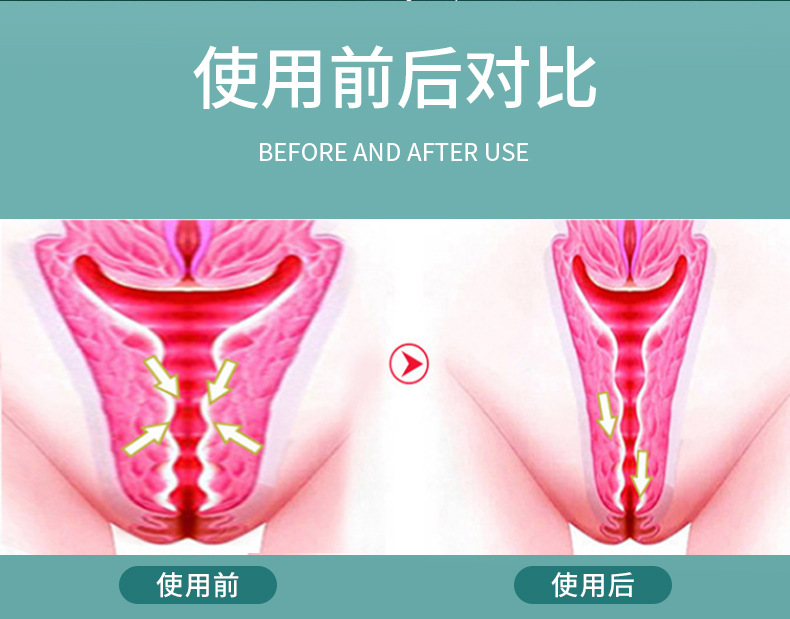 缩液阴加工 美容院私密紧致收缩紧阴液抑菌滋润私处高潮液厂家 商品复购率28.21% 100+人已加购