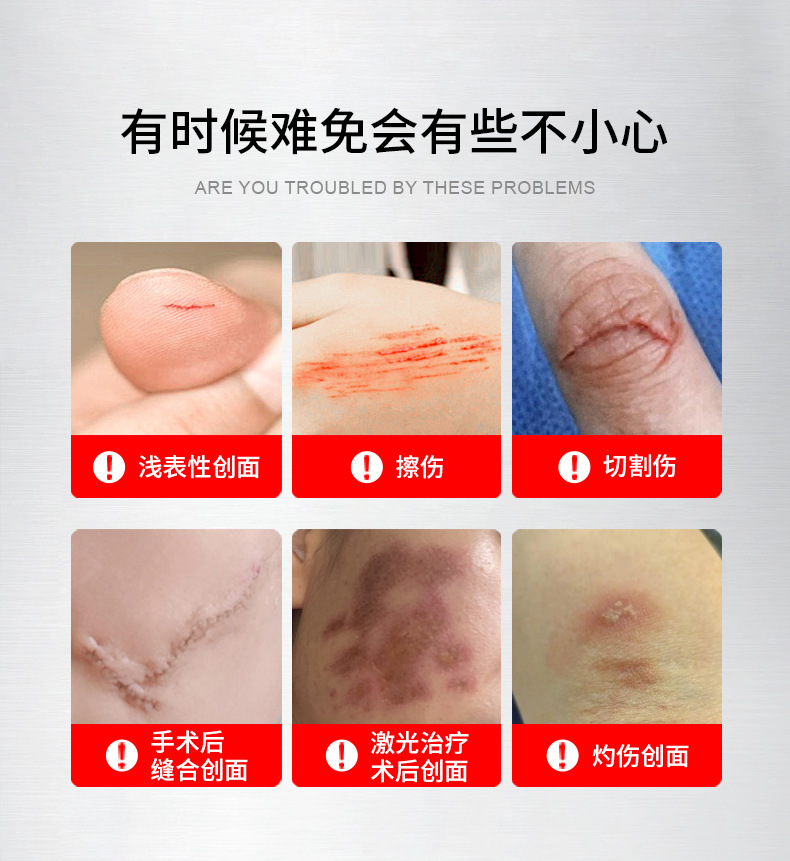医用重组胶原蛋白凝胶医美微形术后创面修护凝胶械字号贴牌代工