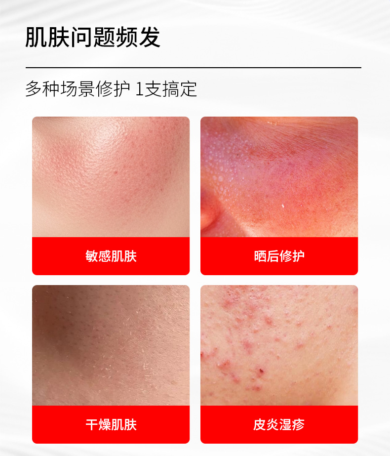 械字号医用透明质酸钠护理凝胶医美术后舒缓泛过敏保湿修护软膏