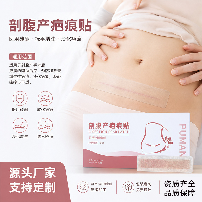 定制械字号剖腹产疤痕贴医用硅酮贴源头工厂支持OEM代工