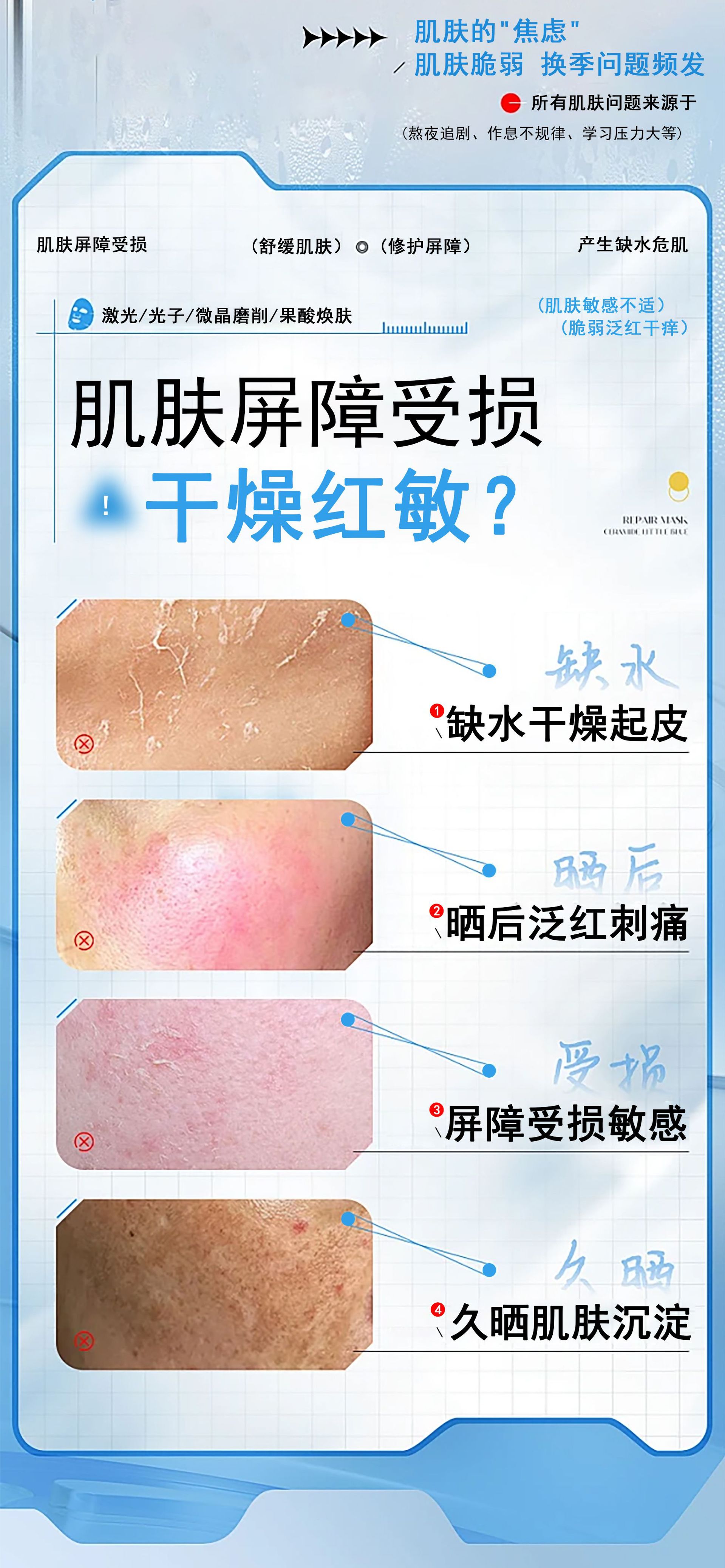 OEM加工医用重组胶原蛋白敷料二类械字号医美术后修护冷敷贴面膜