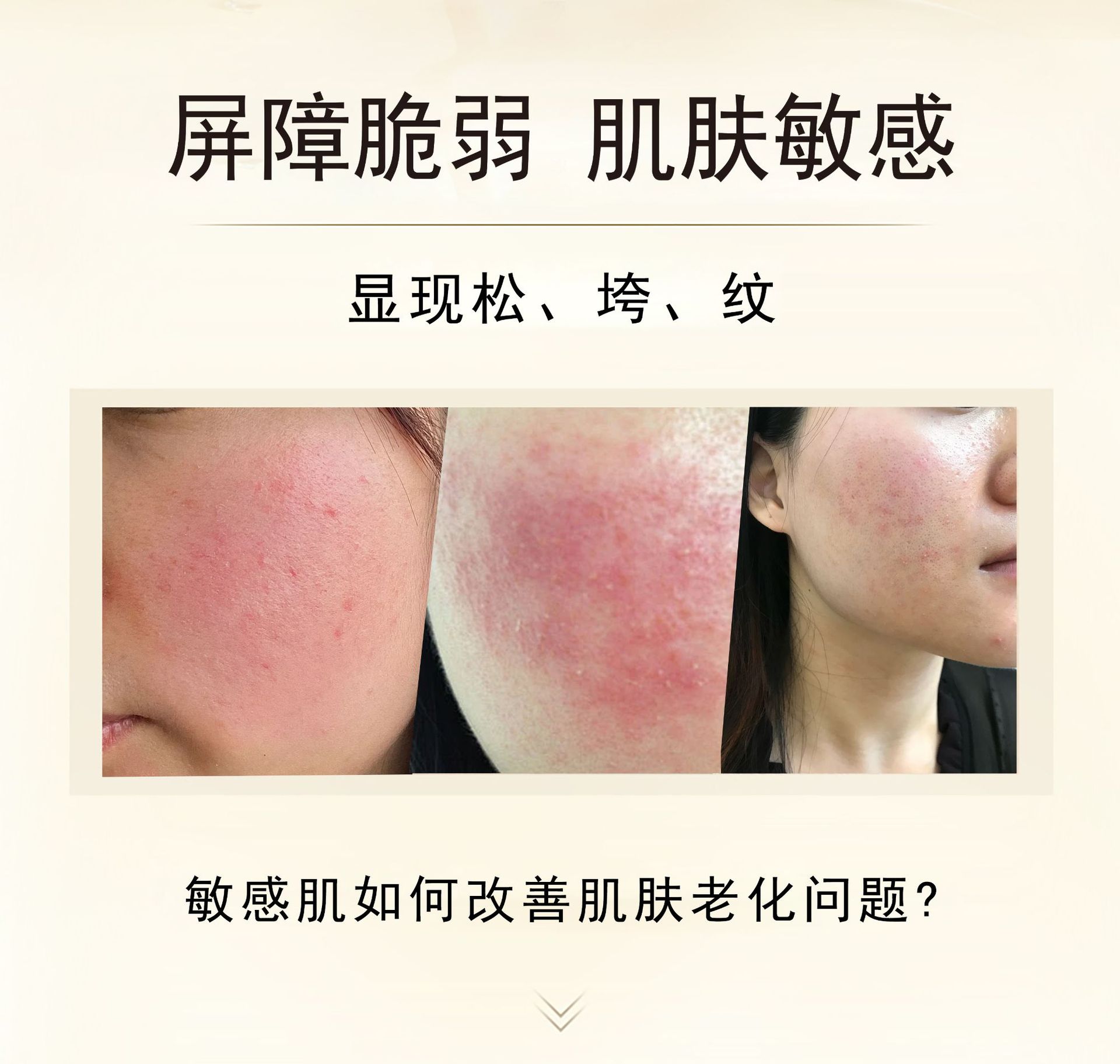 二类医疗器械OEM贴牌定制单片医用重组胶原蛋白敷贴面膜医用冷敷