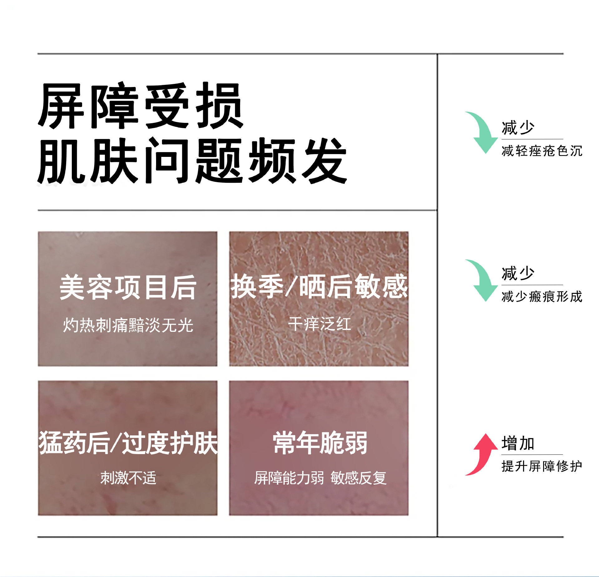 OEM贴牌二类械字号医用重组胶原蛋白敷料医美术后冷敷贴医用敷料