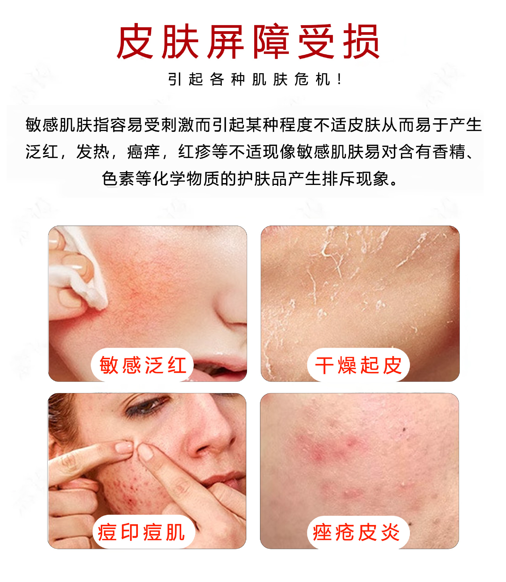 OEM械字号医用退热贴面膜术后修复晒后敏感降温医用敷料贴牌定制