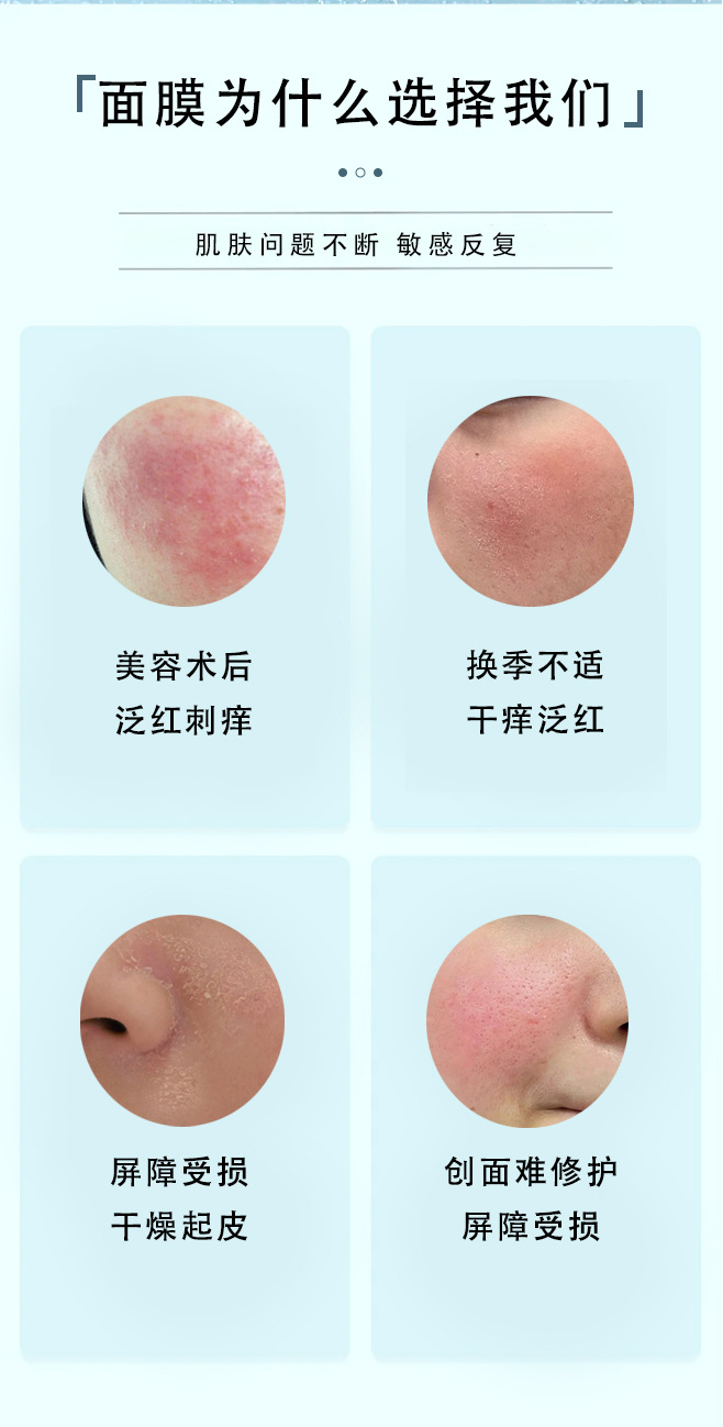 OEM代加工贴牌定制重组胶原蛋白面膜 械字号医美冷敷贴面膜医用级