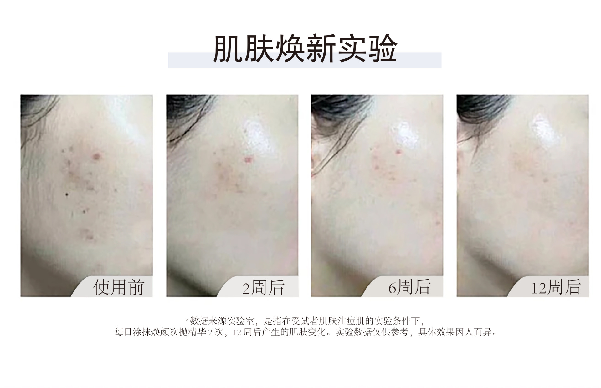 源头工厂二类械字号医用重组胶原蛋白次抛精华OEM贴牌次抛精华