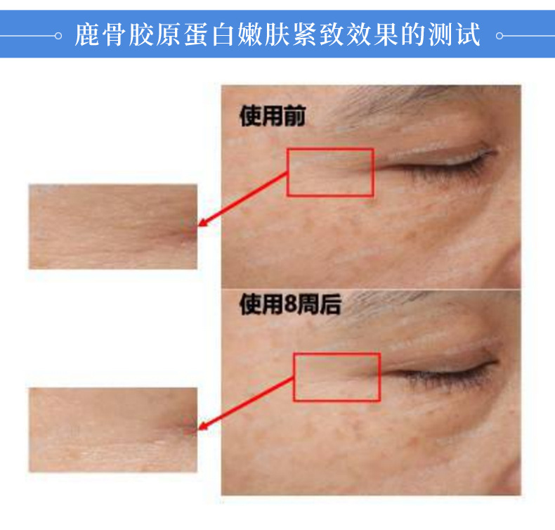 冻干面膜oem护肤品修护祛痘补水面膜鹿骨胶原冻干面膜贴牌代加工
