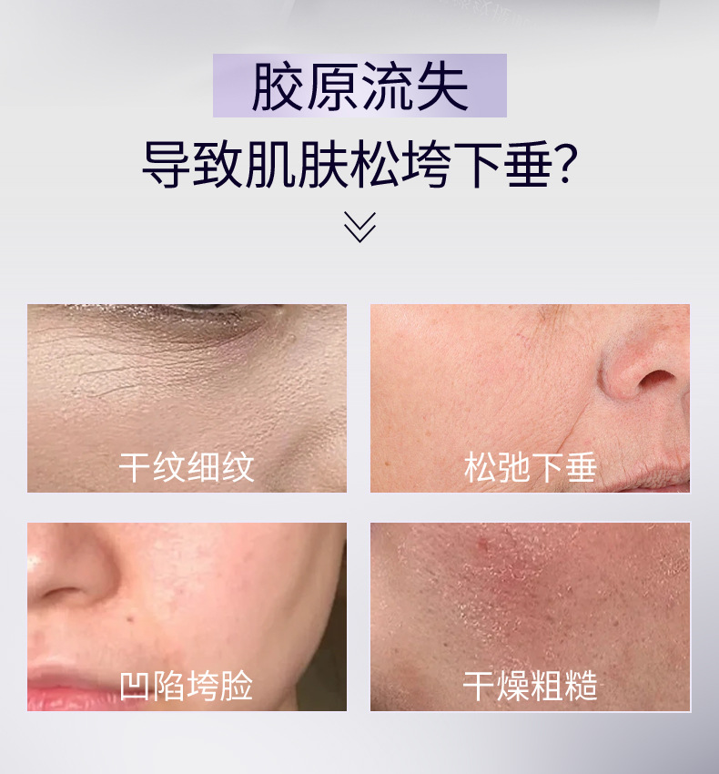 PQQ生物素淡纹膏OEM涂抹固态PQQ抗皱膏面部提拉淡纹紧致加工定制