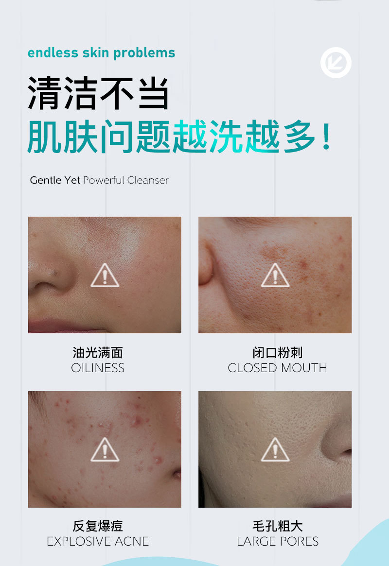 定制跨境爆款壬二酸深层洗面奶oem TK 亚马逊净痘控油洁面代加工